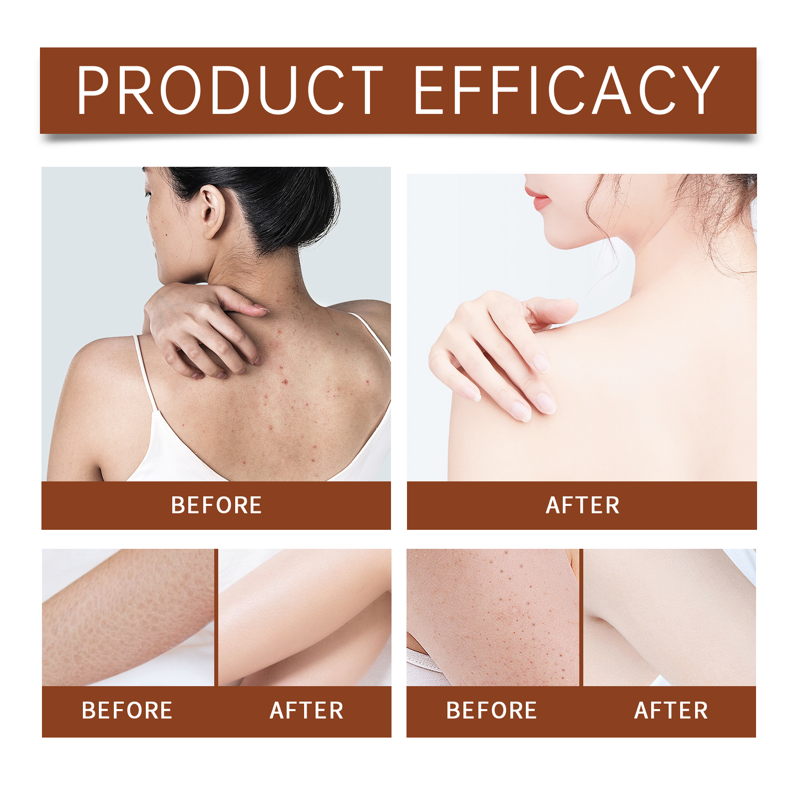 Luxury Body Oil for Dry Skin A - Luxury Glow Skincare reseña y precio
